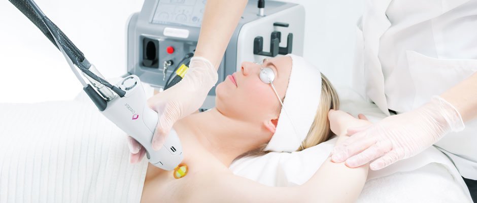 lasersko-uklanjanje-dlaka